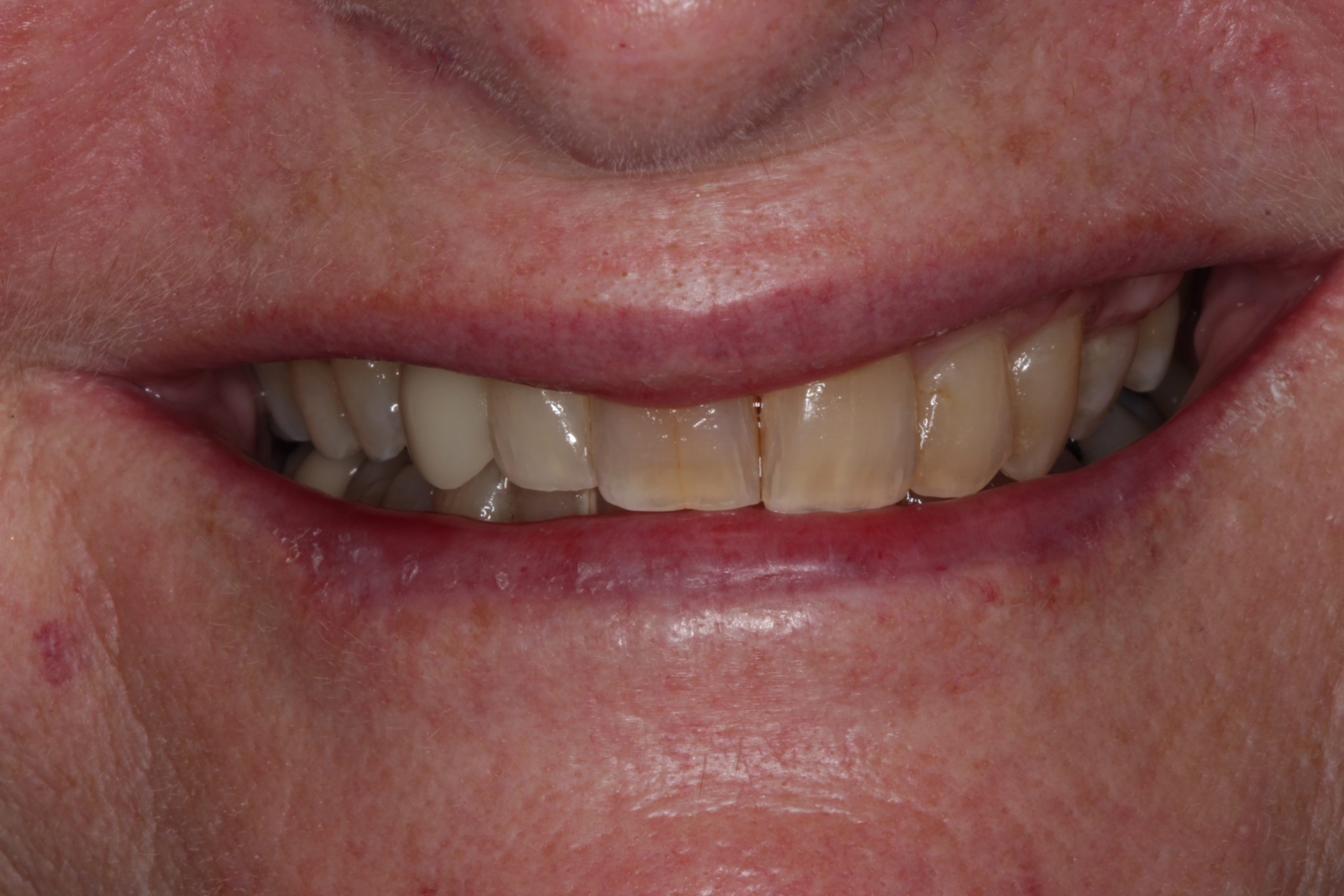 After smiling