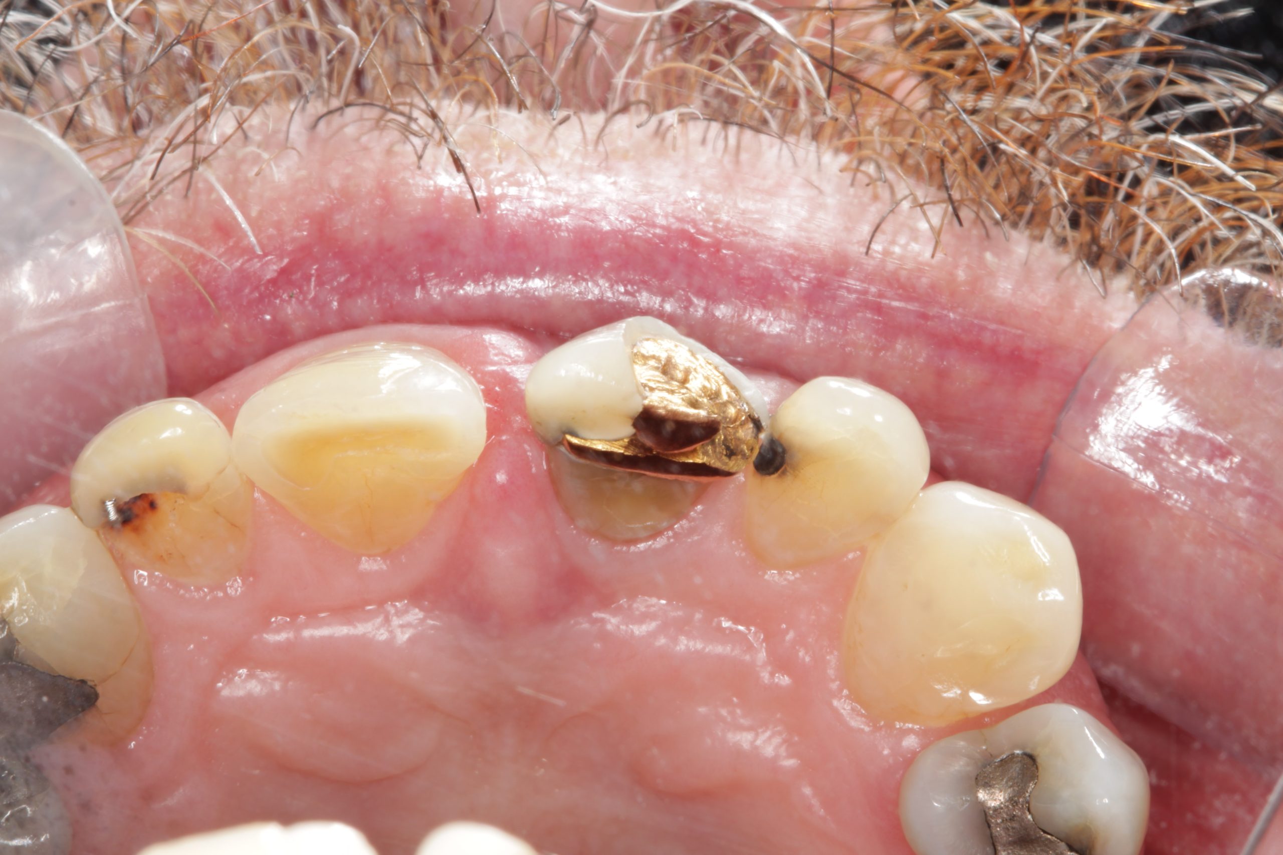 Before Occlusal