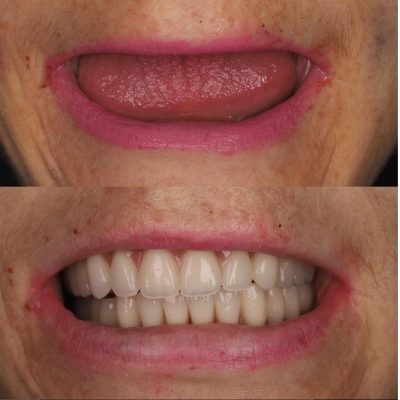 Dr-Abu-Before-After.jpg